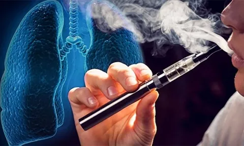Chứa chấp và sử dụng thuốc lá điện tử có thể bị phạt đến 2 triệu đồng
