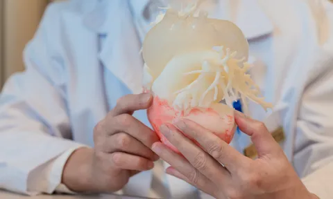Ca thay van động mạch chủ qua da đầu tiên tại Việt Nam ứng dụng công nghệ in 3D cá thể hóa